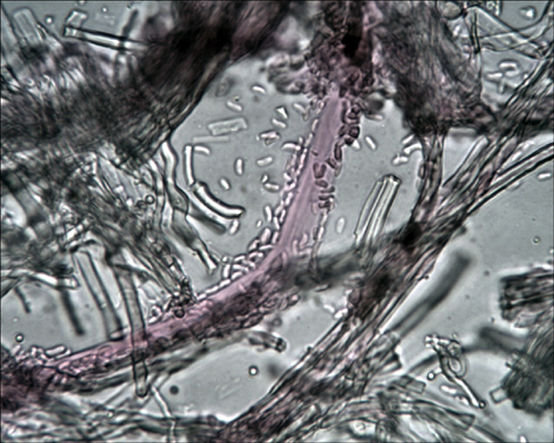 Daedaleopsis tricolor o septentrionalis? (Lenzites betulina)